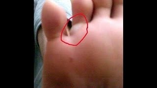 فائدة الاصبع الصغير في القدم معلومة تستحق النشر