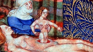 Первый период родов, обезболивание © The first period of labor, anesthesia