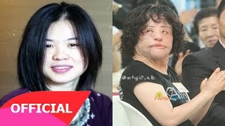 Những thảm họa Thẩm Mỹ tệ hại nhất của Sao châu Á