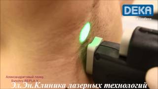 Лазерная эпиляция александритовым лазером Киев видео