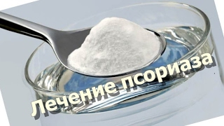 Лечение псориаза пищевой содой - вылечи псориаз народными средствами