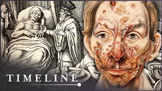 Hidden Killers of the Tudor Home (Tudor Documentary) | Timeline