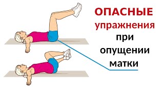 Опасные упражнения при опущении матки. Опущение матки стенок влагалища.