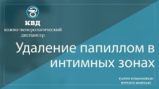 193  Удаление папиллом в интимных зонах