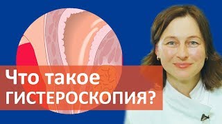 Исследование матки. ? Гистероскопия –один из самых информативных методов исследования матки.