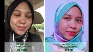Tea Tree 3 Week Challenge | Syairah TEASER