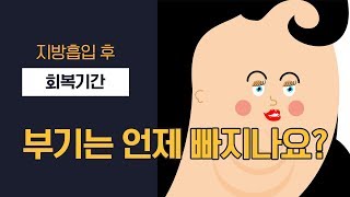 지방흡입 부기는 언제 빠지나요?지방흡입은 안전한가요?