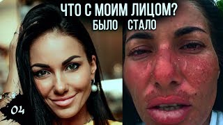 Выжить на Мальдивах! Людей похоронили заживо! Что с моим лицом? Моя первая истерика на острове