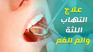 علاج التهاب اللثة والم الاسنان