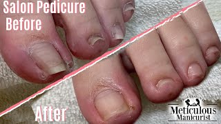 ?Sore Ingrown Toenail Salon Pedicure Transformation How To DIY?