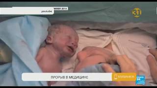 В Бразилии после пересадки матки от мертвого донора женщина родила здорового ребенка