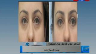 طبيب اليوم | لقاء الدكتورة ماريان نادر اخصائى الجلدية والليزر بمركز نبض