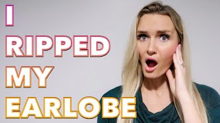 I RIPPED MY EARLOBE IN HALF FROM EARRINGS ? EAR PIERCING RIPS EAR ? TORN EARLOBE REPAIR SURGERY ?‍⚕️