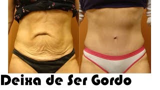 Colágeno Pra Pele da Barriga Vale a Pena? - DR #3