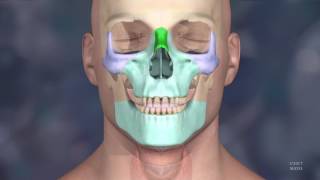 3D Printed Models Used in the Mayo Clinic's First Face Transplant