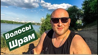 ПРО ВОЛОСЫ, ШРАМ И ВСЕ ОСТАЛЬНОЕ