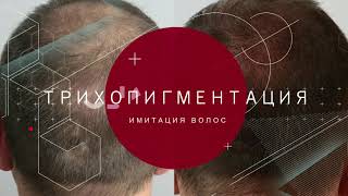 Трихопигментация, татуаж имитация волос на голове.