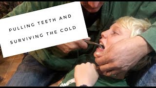 PULLING TEETH and SURVIVING the COLD ~ S1 Ep. 31~ This Life Unlimited ~ Life on the Road ~