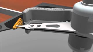 HddSurgery HDDS WDC 3.5" Unstick p4 - Head Unstick Tool