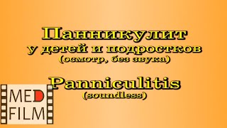 Панникулит у детей и подростков (осмотр) © Panniculitis