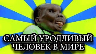 Рекорд Гиннеса: Самый уродливый человек в мире