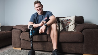 One-Legged Model Becomes Catwalk Star
