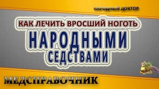 Как лечить вросший ноготь народными средствами. Лечение вросшого ногтя
