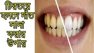 ঘরে বসেই হলদে দাঁতকে সাদা করার জাদুকরী কৌশল যা অবাক করা ফলাফল ১০০% কাজ করবে