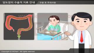 [시연용] c0130aako 담도암의 수술적 치료 안내