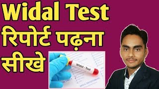 Widal test in hindi / how to read widal test report / widal test कैसे समझे