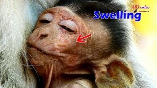 BREAKING HEART ! Poor Jayden get swelling on face after mom torture too hard, Pity Jayden  so hurt