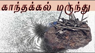 load stone medicine /காந்தக்கல்  மருத்துவம் /magnet stone