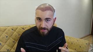 Saç Ekimi 2. Gün ( Baştan sona Detaylı anlatım)  Hair Transplant