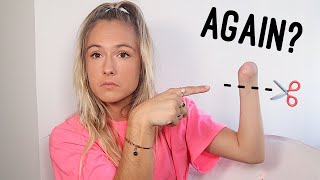 I Had To Get My Arm Amputated.. AGAIN // Amputee Storytime