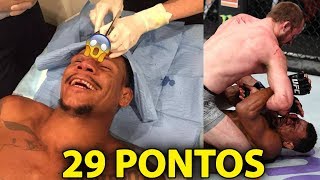 Cotovelada fez ESTRAGO em brasileiro no UFC 231!