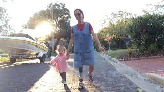 Angelina,  Hemipelvectomy Amputee Walking with Confidence