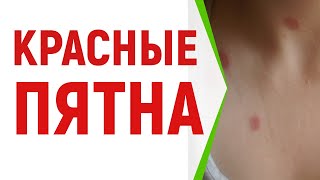 Красные пятна