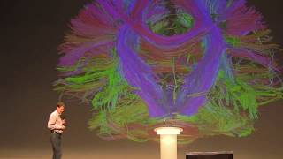 Fréjus 2019 - Laurent Alexandre : Transhumanisme et intelligence artificielle