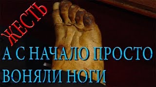 ПОЧЕМУ ВОНЯЮТ НОГИ /ЖЕСТЬ/НЕ ПРИЯТНЫЙ ЗАПАХ ОТ НОГ.[IN THE TREND]