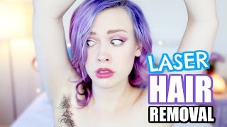 LASER HAIR REMOVAL Before & After 4 months | Laseraway