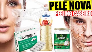 PEELING CASEIRO | TIRA CRAVOS, OLEOSIDADE,  MANCHAS, CLAREIA E HIDRATA A PELE