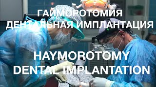 Ревизия гайморовой пазухи, дентальная имплантация. Профессор Орлов