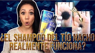 Shampoo del Tío Nacho ¿realmente funciona? - Documentado