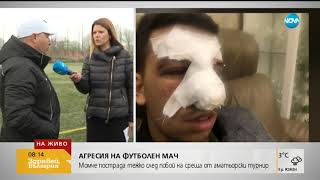 Момче пострада тежко след побой на мач от аматьорски турнир (08.04.2019г.)