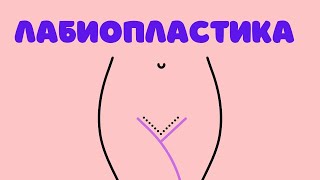 Губища, губы, губки - гинеколог о лабиопластике,  1 часть. - Др. Елена Березовская