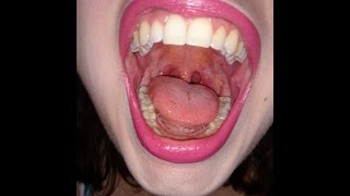 Swallowing gummy worms whole and some chewing