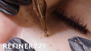 I Got Faux Freckles Tattooed On My Face | Macro Beauty | Refinery29