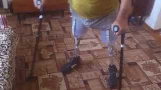 Парная ампутация. Bilateral amputation