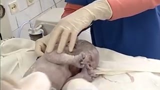 Рождение ребенка Реальные съемки в роддоме