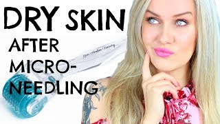 Why You Have Dry Skin After Dermarolling